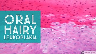 Oral Hairy LeukoplakiaExplained by a Dermatopathologist [upl. by Iggie418]