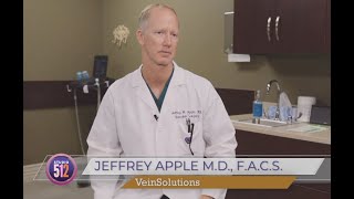 VenaSeal Varicose Vein Treatment [upl. by Meredi388]