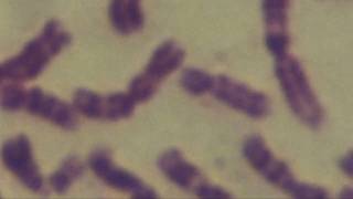 Cytogenetics Human chromosomes Karyotype [upl. by Eenehs]