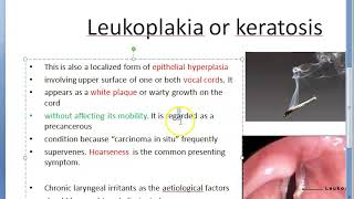 ENT 359 a Leukoplakia Keratosis Larynx PreMalignant lesion vocal cord precancerous [upl. by Eat986]