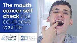 How to do a mouth cancer check at home [upl. by Zoa570]