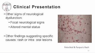 1 Overview meningitis and encephalitis [upl. by Annhoj180]