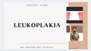 LEUKOPLAKIA [upl. by Zabrine]