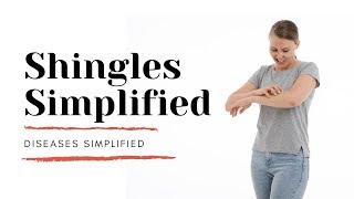 Shingles Simplified [upl. by Isola]